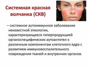 Инвалидность при скв в россии